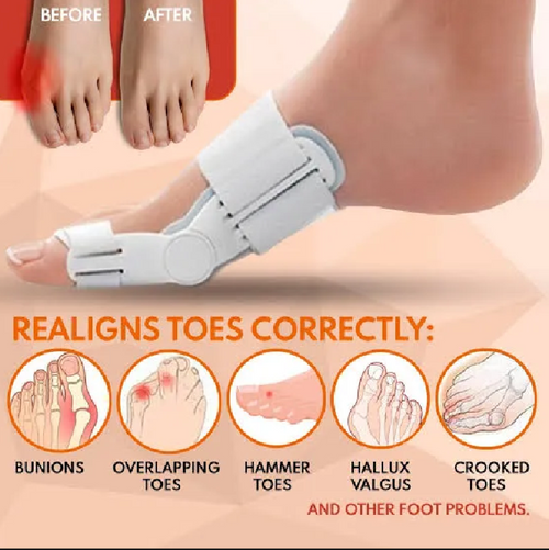 Adjustable Bunion Corrector Brace